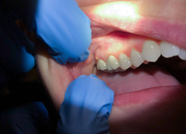 Best Emergency Dentist for Special Needs Patients in Warrenvle, IL